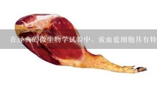 在经典的微生物学试验中,鲎血蓝细胞具有特殊的应用领域,请问鲎试验用于对何种物质的测定 在经典的微生物学试验中,鲎血蓝细胞具有特殊的应用领域,请问鲎试验用于对何种物质的测定