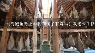 被海鲢鱼背上的刺划伤了有毒吗?我老公手指被海鲢鱼背上的刺划伤了,现在指以肿好大,也非常胀痛。 被海鲢鱼背上的刺划伤了有毒吗?我老公手指被海鲢鱼背上的刺划伤了,现在指以肿好大,也非常胀痛。